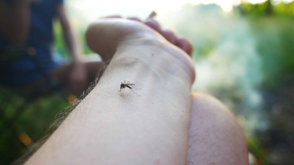 mosquito-bites-hand